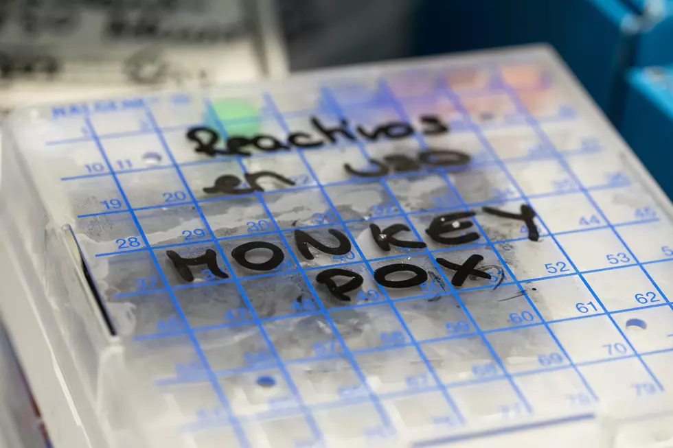 First Case of Monkeypox Identified in Louisiana