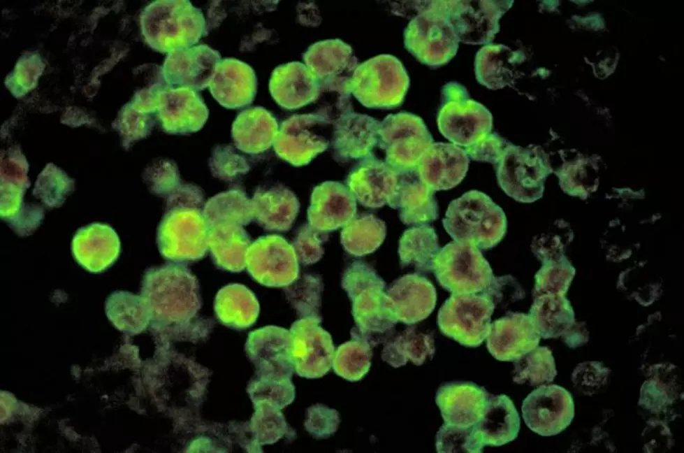 Water In Part Of Terrebonne Parish Tests Positive For Brain Eating Amoeba [Video]