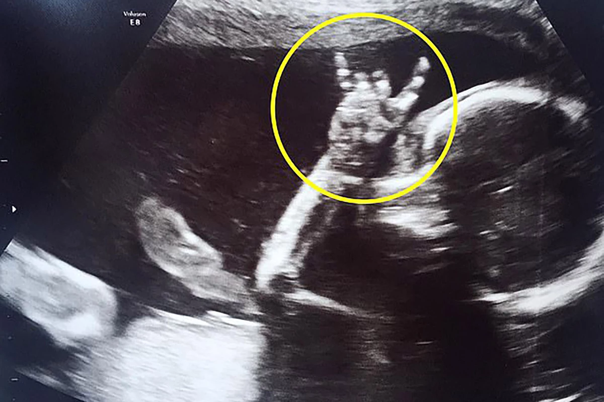 Baby Throws Horns in Ultrasound Proving She's Cooler Than Us