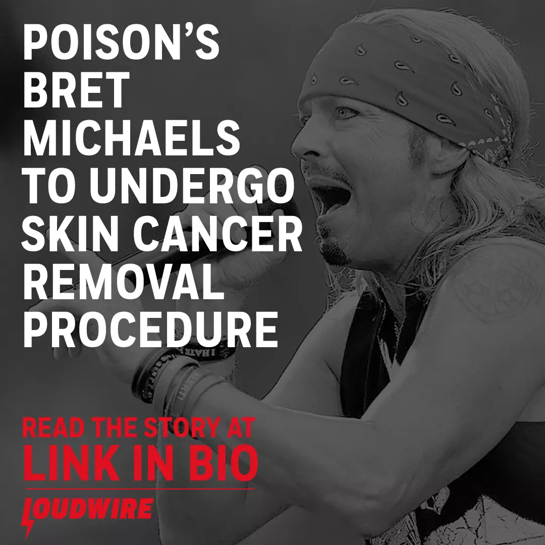 Poison S Bret Michaels Undergoing Skin Cancer Removal Procedure