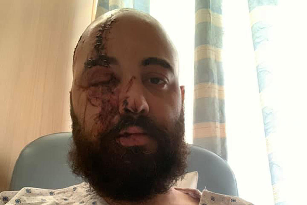 Metal Drummer Injured in Beirut Explosion