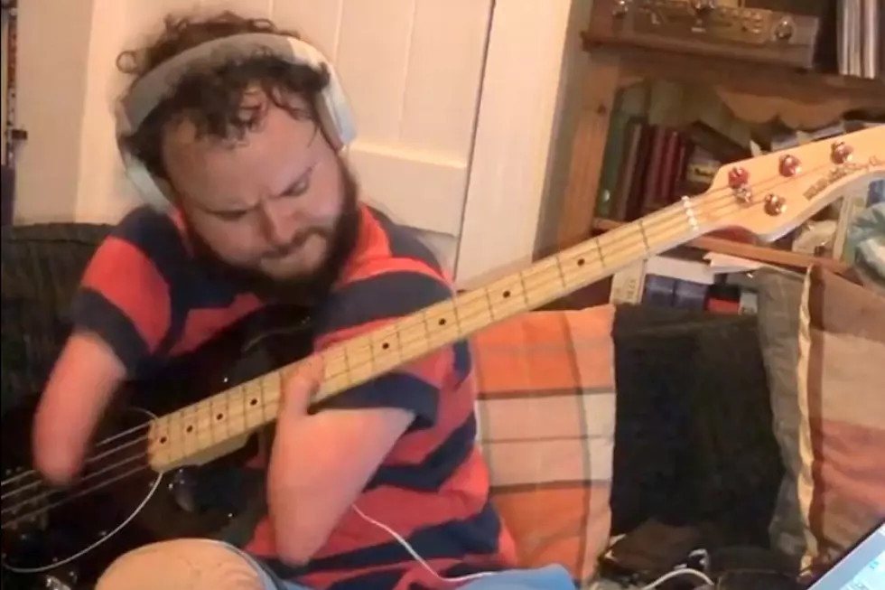 Musician With No Forearms Nails Red Hot Chili Peppers on Bass