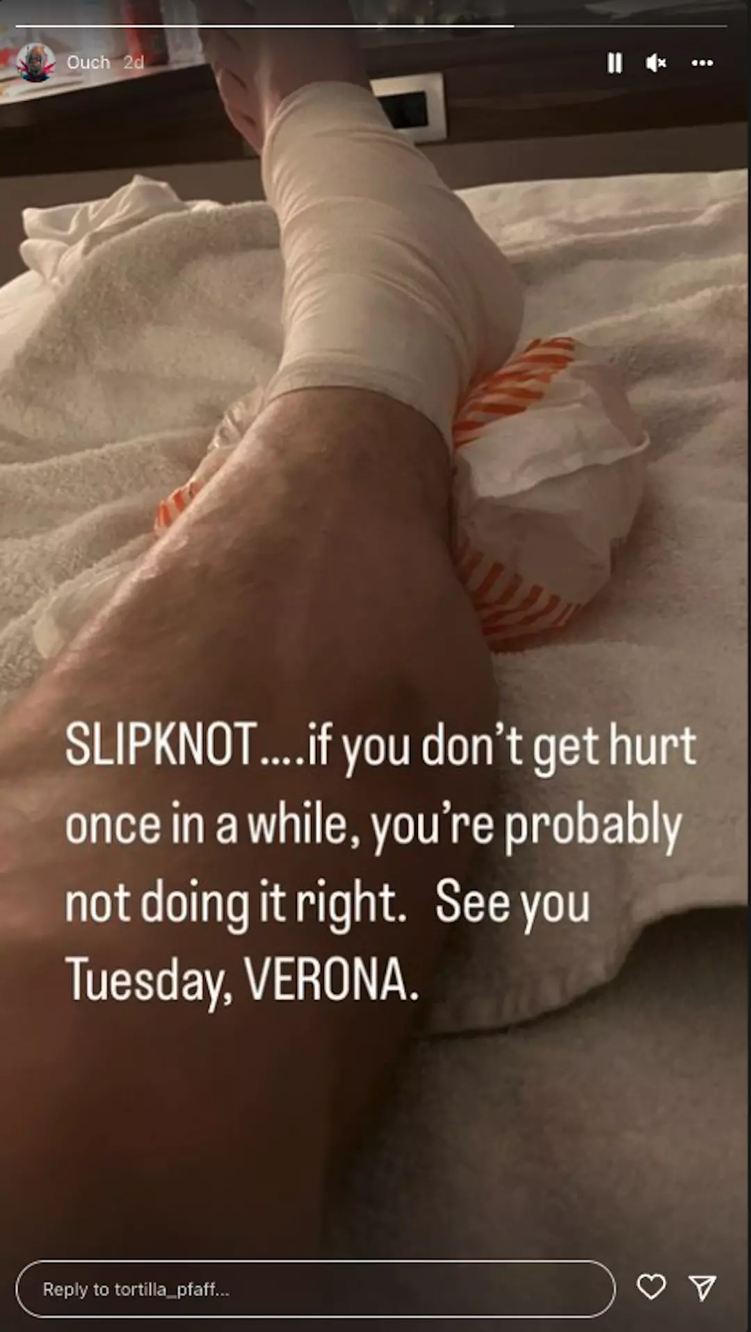 Leg Brace Porn Captions - Slipknot's Michael Pfaff Injures Ankle on Tour, Shares Photos