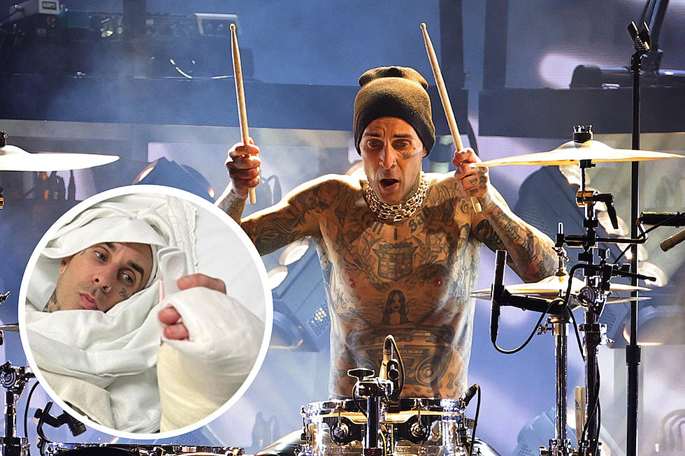 Travis Barker Shares Graphic Update Following Surgery for Injured Finger