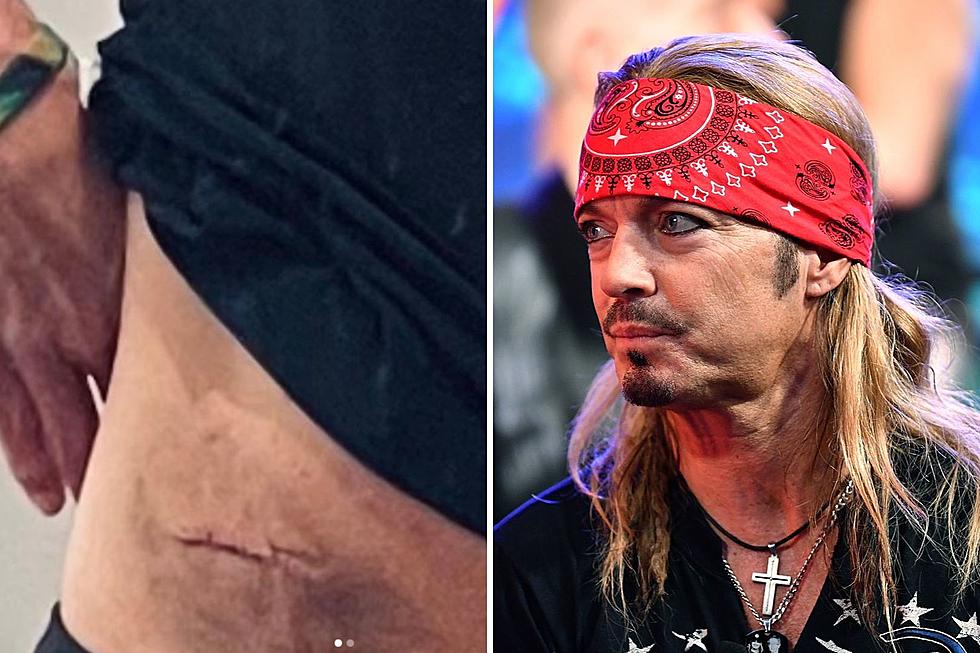 Poison’s Bret Michaels Opens Up About Skin Cancer Scare Following Medical Procedure