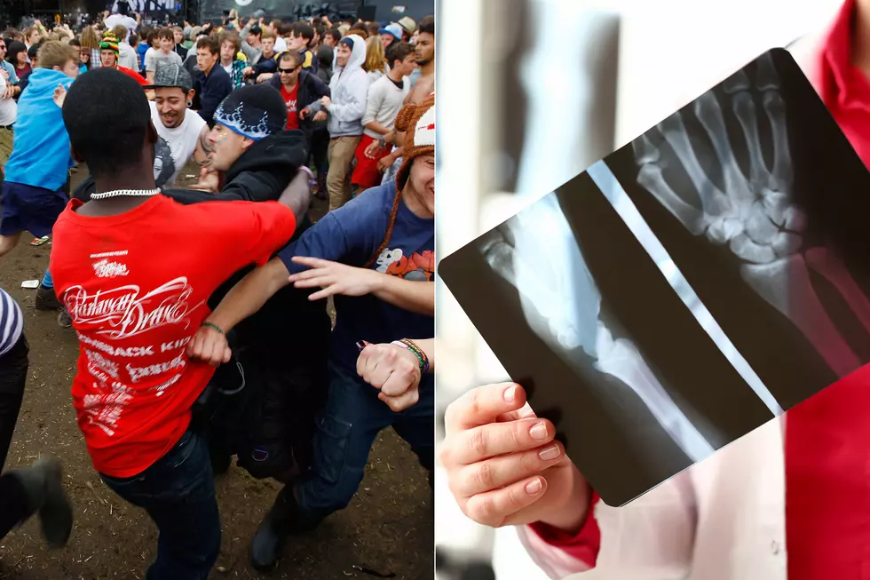 What's Your Worst Mosh Pit Injuries? Reddit Users Weigh In