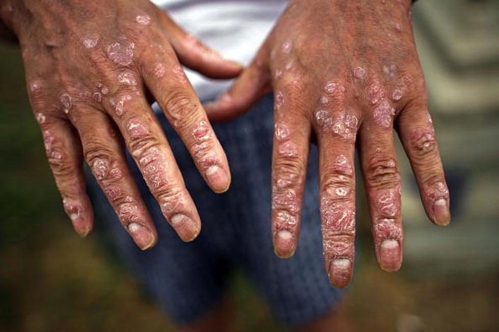 October Is Agent Orange Awareness Month October Is Agent Orange Awareness Month