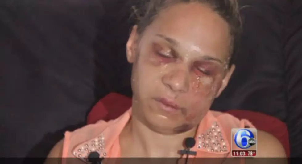 South Jersey woman discusses beating