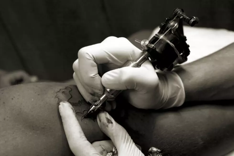 Tattoo removal is booming