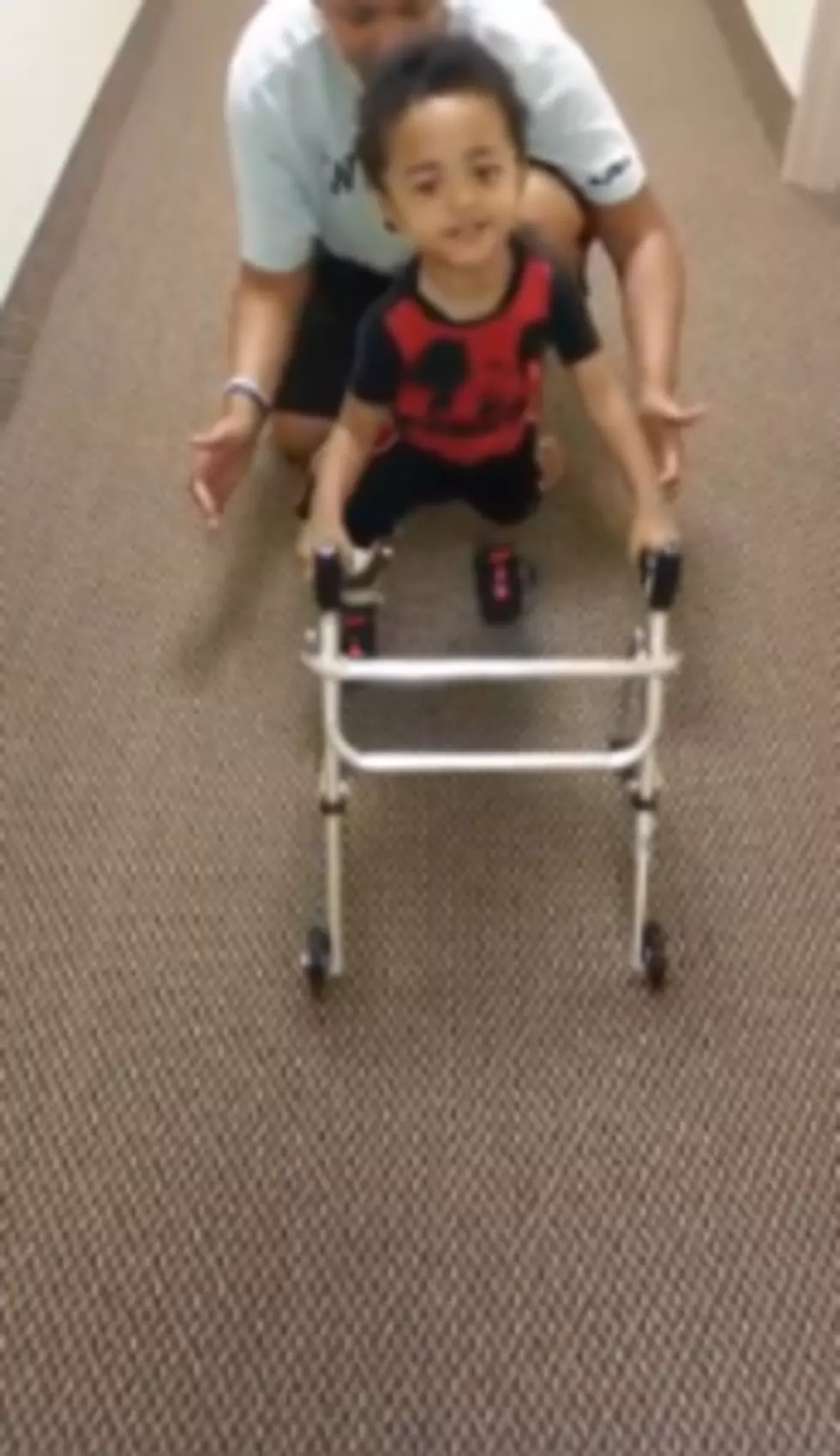 Watch: Toddler learns to walk again after amputations 