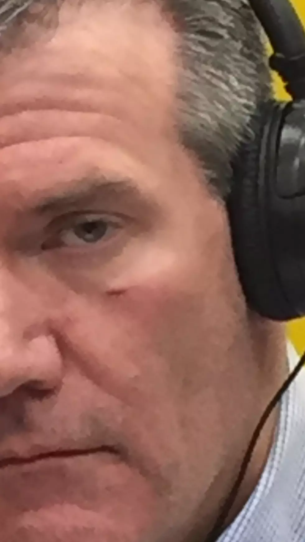 Here is the result of Bill Doyle&#8217;s dumb injury (Photo)