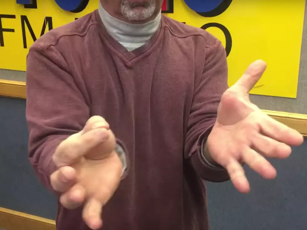 Dennis Malloy shows off his bizarre hand trick