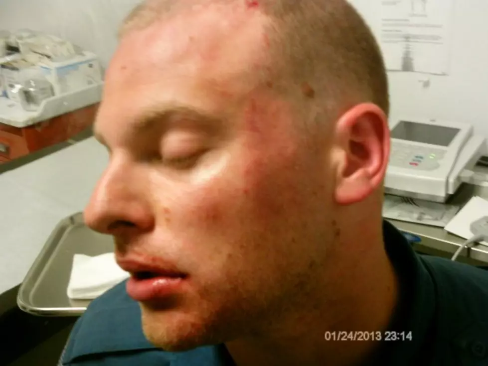 Officer punched 36 times in NJ prison attack, renewing PBA&#8217;s push for new law