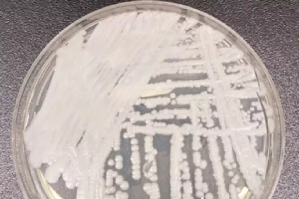 Drug-Resistant Fungus Diagnosed in 3 NJ Residents