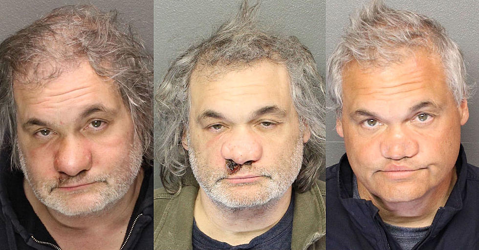 &#8216;Botched&#8217; doc promises to fix Artie Lange&#8217;s nose &#8230; if he gets clean