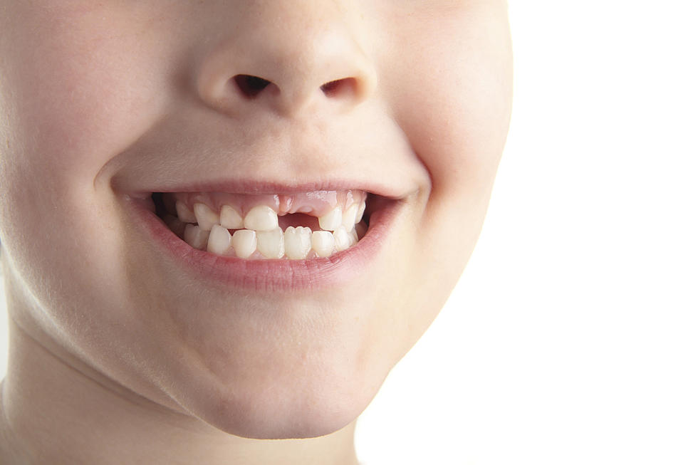 Nat’l Tooth Fairy Day — Is your kid getting shortchanged?