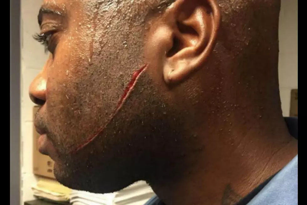 NJ prison cop slashed in face — Will he get full benefits?