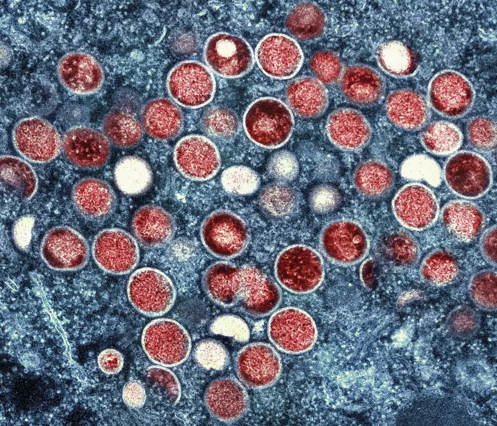 First monkeypox-related death reported in New Jersey