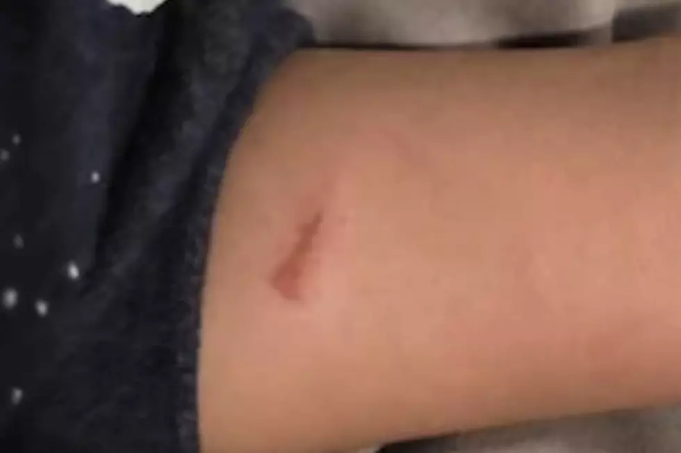 One of the cuts on Daylan Wilkins (ABC 7 Eyewitness News)