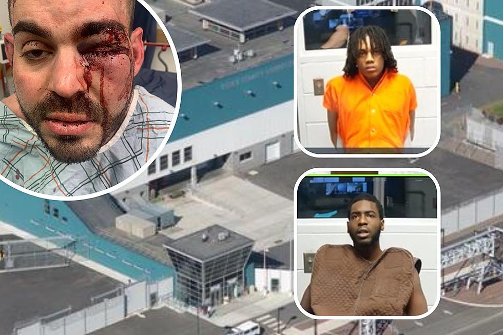 PHOTOS: NJ corrections officer nearly loses eye after attack by inmates