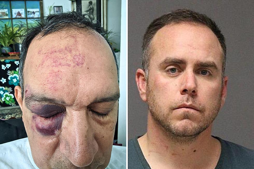 Victim beaten by drunk, off-duty NJ cop unhappy with plea deal