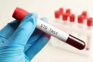 How NJ ranks in STD cases compared to the rest of the U.S.