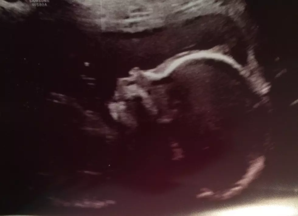 Varacchi&#8217;s Baby Blog &#8211; The Latest Sonograms