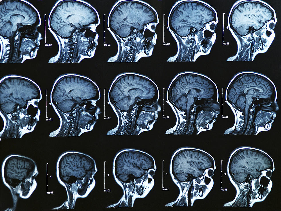 Study Says There is No Difference Between Male and Female Brain