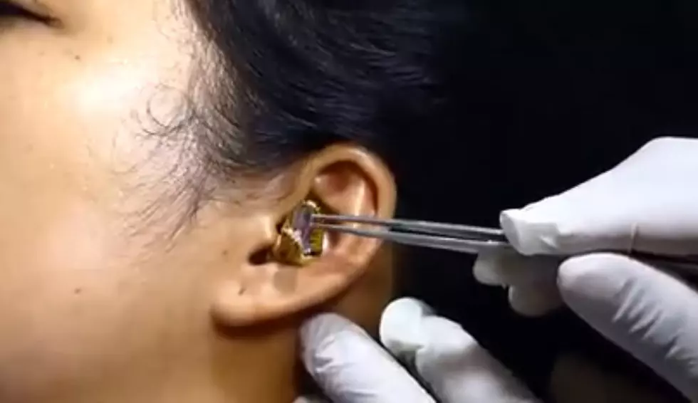 Is This Real? Shocking Video Shows Snake Being Pulled Out Of Woman&#8217;s Ear