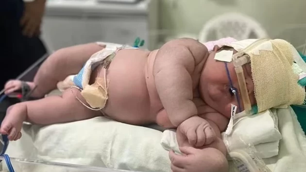Baby Is 2 Feet Tall, 16 lbs At Birth Almost Beating NJ's Biggest