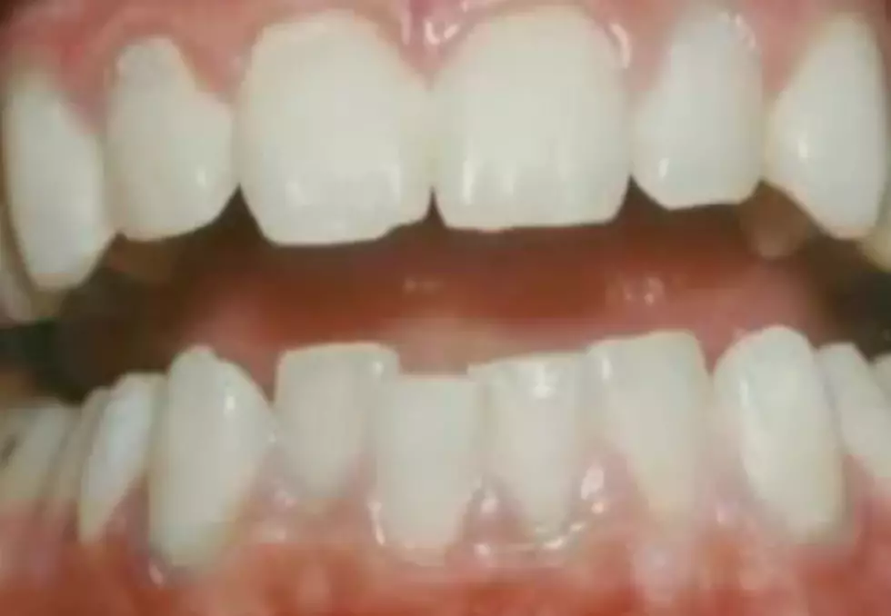 Gum Disease Linked To Arthritis? Experts Say Yes.