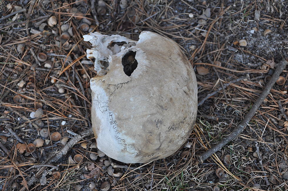 Human Skull Unearthed In Ocean County