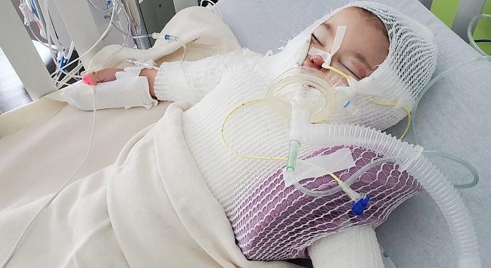 NJ toddler suffers severe burns after candle catches dress on fire