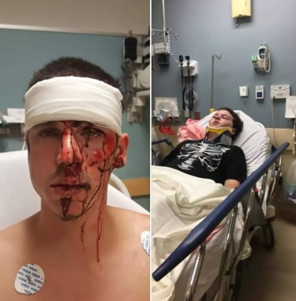 Cousins Attacked, Beaten While Trick or Treating in Egg Harbor