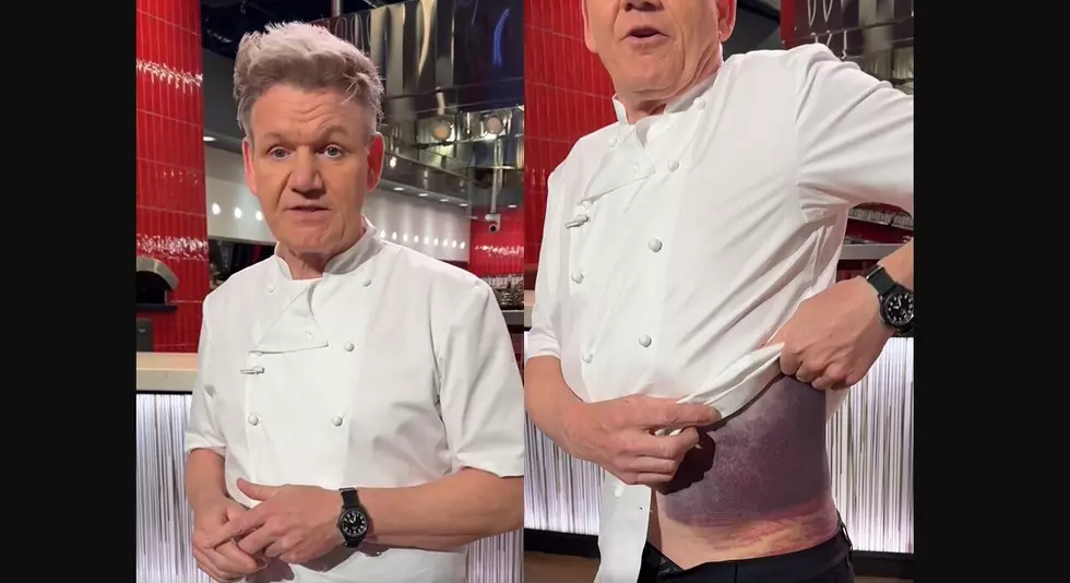 Black & Blue Gordon Ramsey Says He’s ‘Lucky to Be Here’