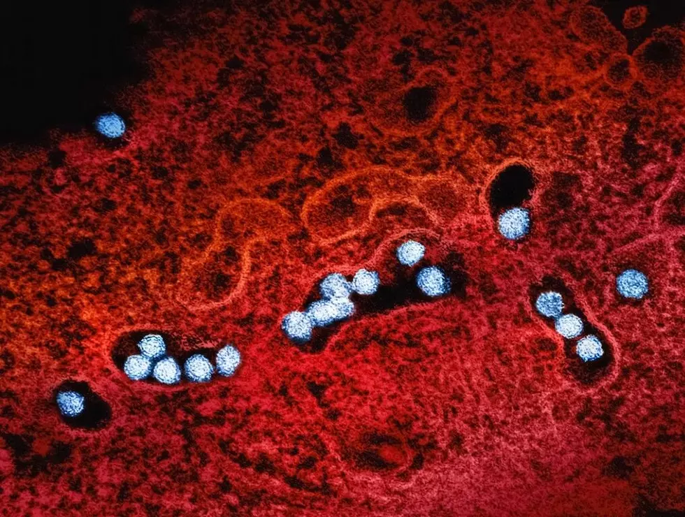 The National Institute of Allergy and Infectious Diseases