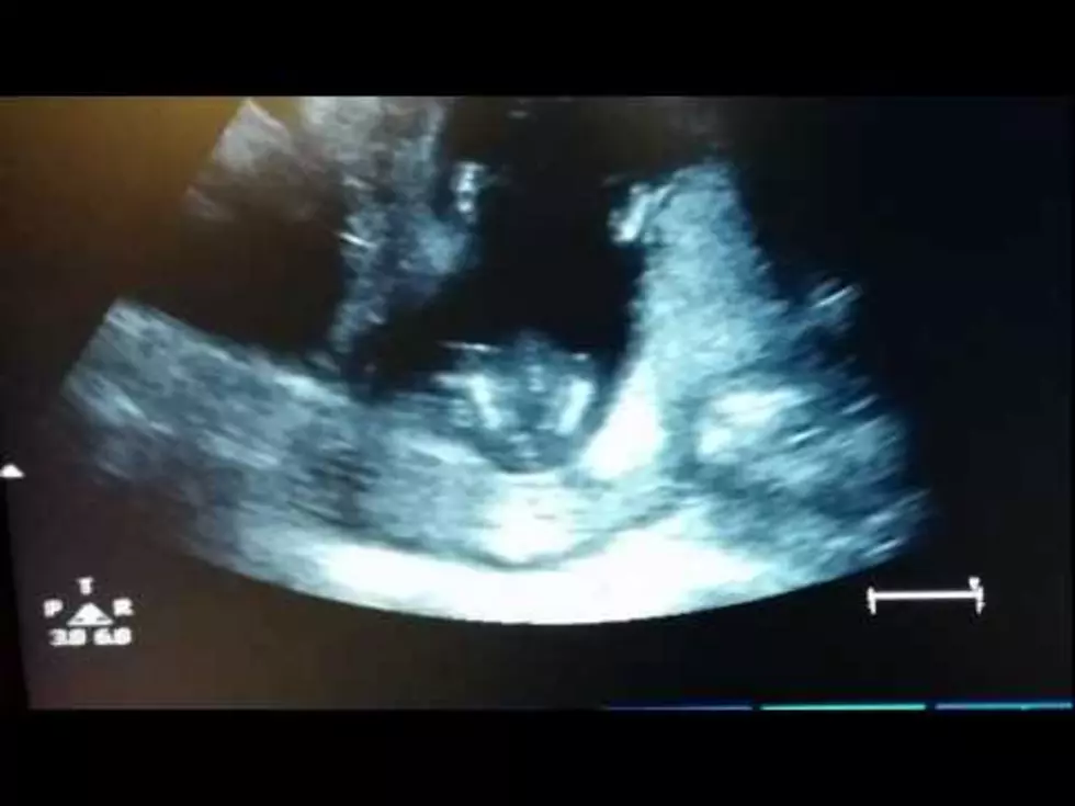 Soon to be Born Baby Claps it’s Hands to ‘If You’re Happy and You Know it’ in Ultrasound [VIDEO]