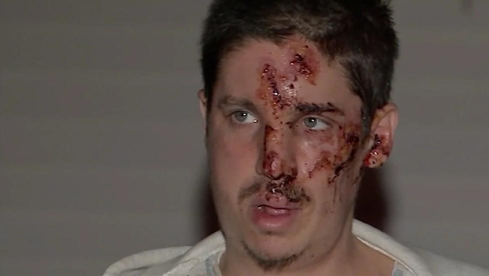 Update on Egg Harbor City Man Brutally Attacked on Halloween Night