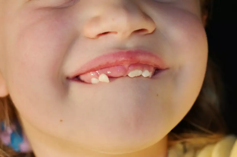 CNY Tooth Fairy Paying Above Average Rates