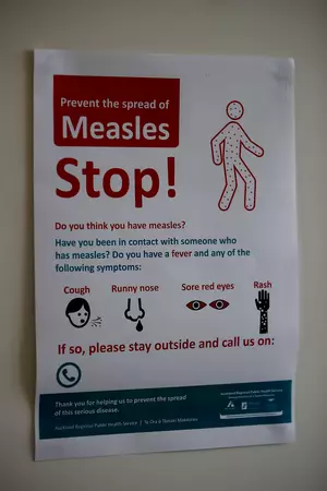 Two Measles Cases Confirmed in Oneida County, Both Unvaccinated