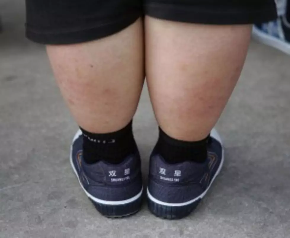 Fat Kids Think Their Weight Is Normal, Study Finds