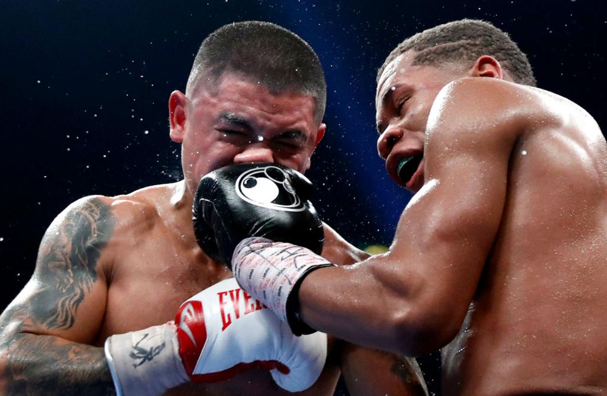 Overprotected Boxer 21 Photos Make it Painfully Obvious Why You Do Not Want to Box