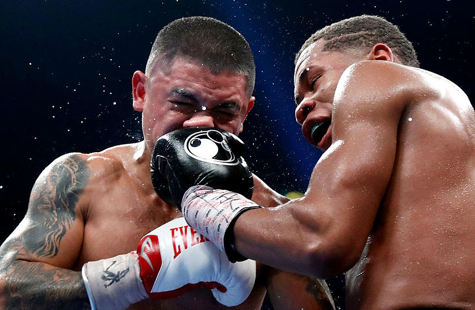 21 Photos Make it Painfully Obvious Why You Do Not Want to Be a Boxer