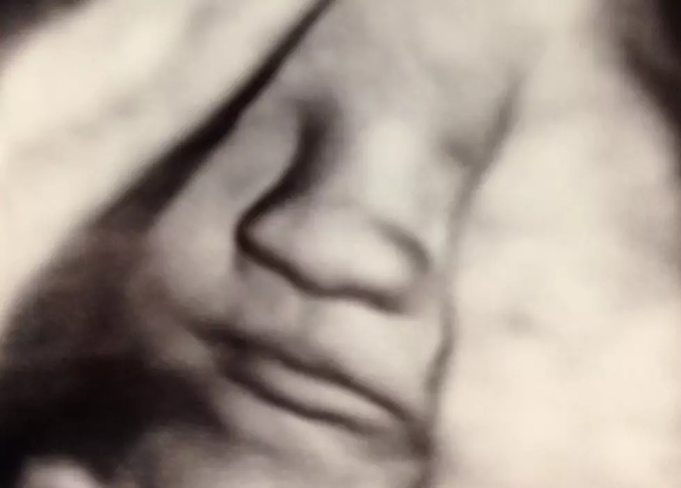 The Most Mind-blowing 4D Sonogram Photo You’ve Ever Seen
