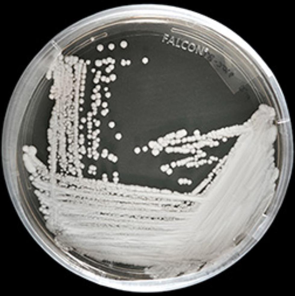 Over 300 Confirmed Cases Of 'Deadly Fungal Superbug' In NYS
