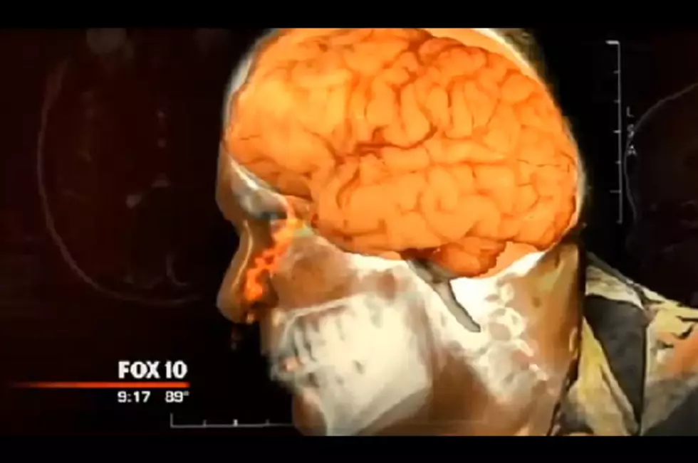 Man’s Runny Nose Turns Out Being A Leaky Brain [FBHW]