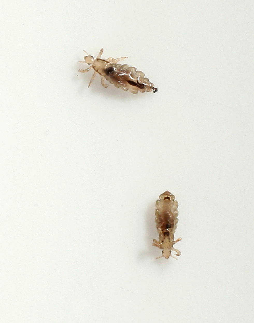 An Absolutely Disgusting Head Lice Infestation [Video]