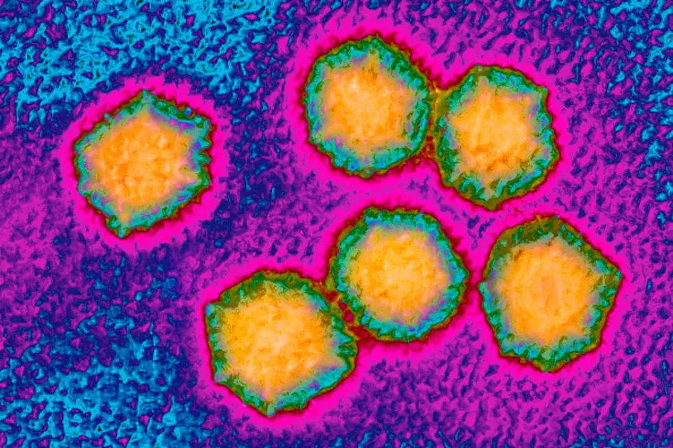 Michigan Hepatitis A Outbreak Now in Kent County