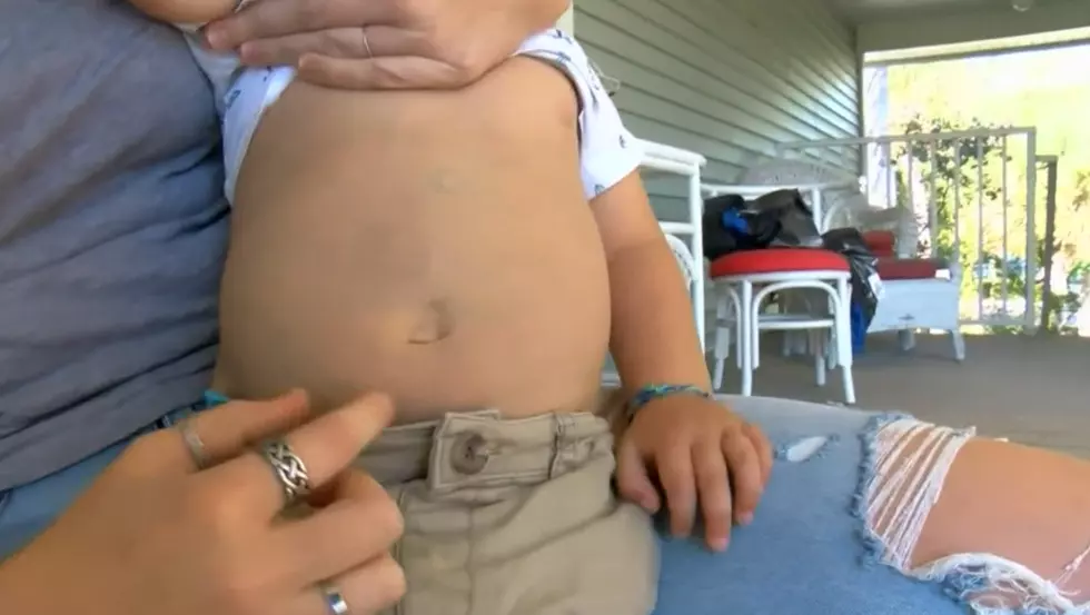 Daycare Worker Writes Passive Aggressive Note On Child’s Stomach In Permanent Marker