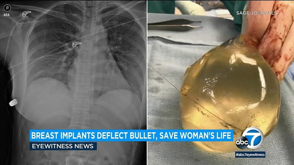 You Won’t Believe What Saved This Woman’s Life